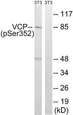 Phospho-VCP (Ser352) Antibody in Western Blot (WB)