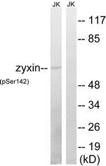 Phospho-Zyxin (Ser142) Antibody in Western Blot (WB)