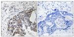 Phospho-FHIT (Tyr114) Antibody in Immunohistochemistry (Paraffin) (IHC (P))