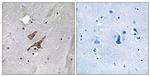 Phospho-TSC2 (Tyr1571) Antibody in Immunohistochemistry (Paraffin) (IHC (P))