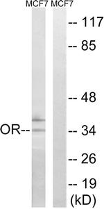 OR51H1P Antibody in Western Blot (WB)