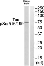 Phospho-Tau (Ser199, Ser516) Antibody in Western Blot (WB)