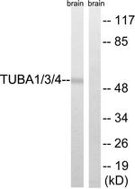 TUBA1/3/4 Antibody in Western Blot (WB)