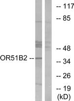 OR51B2 Antibody in Western Blot (WB)
