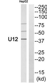 HHV-7 U12 Antibody in Western Blot (WB)