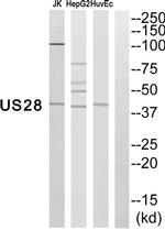 Cytomegalovirus US28 Antibody in Western Blot (WB)
