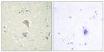 NKTR Antibody in Immunohistochemistry (Paraffin) (IHC (P))