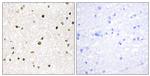 AKAP11 Antibody in Immunohistochemistry (Paraffin) (IHC (P))