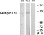 COL1A2 Antibody in Western Blot (WB)