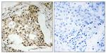 Phospho-RARA (Ser77) Antibody in Immunohistochemistry (Paraffin) (IHC (P))