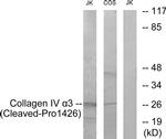 COL4A3 (Cleaved Pro1426) Antibody in Western Blot (WB)