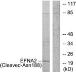 Ephrin A2 (Cleaved Asn188) Antibody in Western Blot (WB)