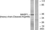 MASP1 (Cleaved Arg448) Antibody in Western Blot (WB)