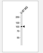 MBTPS1 Antibody in Western Blot (WB)