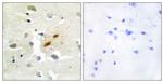 REV3L Antibody in Immunohistochemistry (Paraffin) (IHC (P))