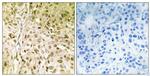 POLQ Antibody in Immunohistochemistry (Paraffin) (IHC (P))