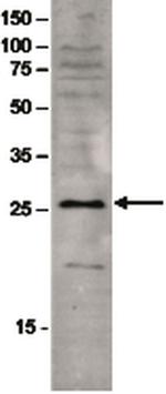 SAP30 Antibody in Western Blot (WB)