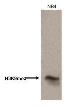 H3K9me3 Antibody in Western Blot (WB)