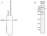 SKI3 Antibody in Western Blot (WB)