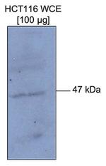 Methyl-p53 (Lys372) Antibody in Western Blot (WB)
