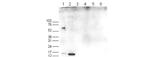 H3K17me2aK18ac Antibody in Western Blot (WB)