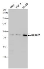 CCDC27 Polyclonal Antibody