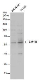 ZNF486 Antibody in Western Blot (WB)