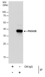 PHOX2B Antibody in Immunoprecipitation (IP)
