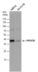 PHOX2B Polyclonal Antibody