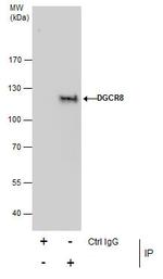 DGCR8 Antibody in Immunoprecipitation (IP)