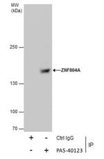 ZNF804A Antibody in Immunoprecipitation (IP)