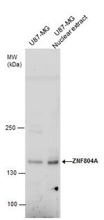 ZNF804A Antibody in Western Blot (WB)
