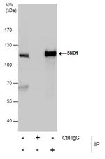 SND1 Antibody in Immunoprecipitation (IP)