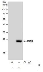 MIS12 Antibody in Immunoprecipitation (IP)