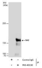 STAG2 Antibody in Immunoprecipitation (IP)