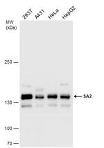 STAG2 Antibody in Western Blot (WB)