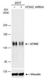 Ataxin 2 Antibody in Western Blot (WB)