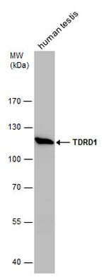 TDRD1 Antibody in Western Blot (WB)