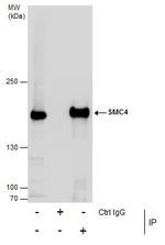 SMC4 Antibody in Immunoprecipitation (IP)
