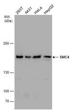 SMC4 Polyclonal Antibody