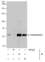 Glutaminase C (GAC) Antibody in Immunoprecipitation (IP)