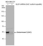 Glutaminase C (GAC) Antibody in Western Blot (WB)