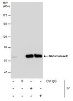 Glutaminase C (GAC) Antibody in Immunoprecipitation (IP)