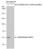 Glutaminase C (GAC) Antibody in Western Blot (WB)