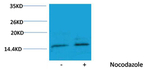 Phospho-Histone H3 (Ser10) Antibody in Western Blot (WB)