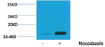 Phospho-Histone H3 (Thr32) Antibody in Western Blot (WB)