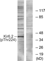 Phospho-Kir6.2 (Thr224) Antibody in Western Blot (WB)