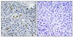 Phospho-TOP2A (Ser1106) Polyclonal Antibody