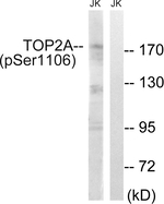 Phospho-TOP2A (Ser1106) Antibody in Western Blot (WB)