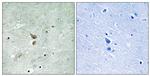 Phospho-RIP2 (Ser176) Polyclonal Antibody